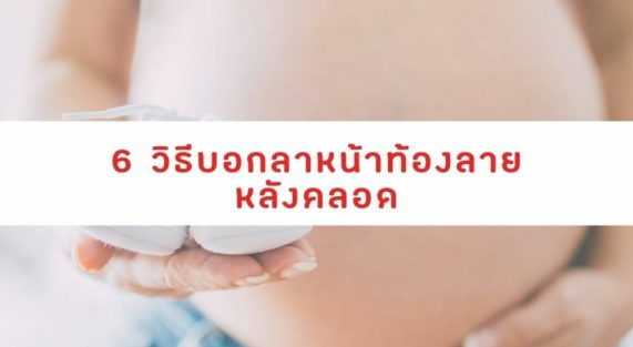 วิธีบอกลาหน้าท้องลายหลังคลอด
